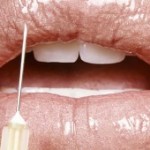 Restore Youth and Beauty With Voluma