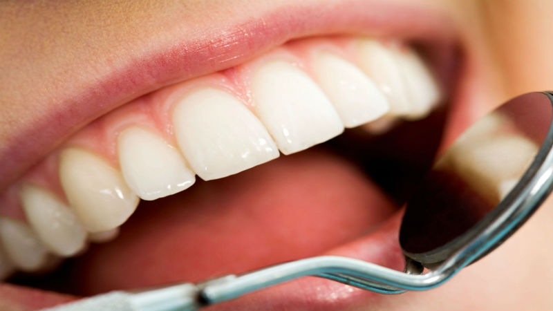 What are Dental Implants in Keizer OR Used For?