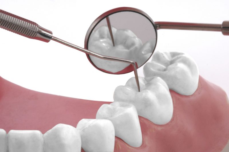 How Can a Cosmetic Dentist in Nipomo, CA Improve Your Smile?