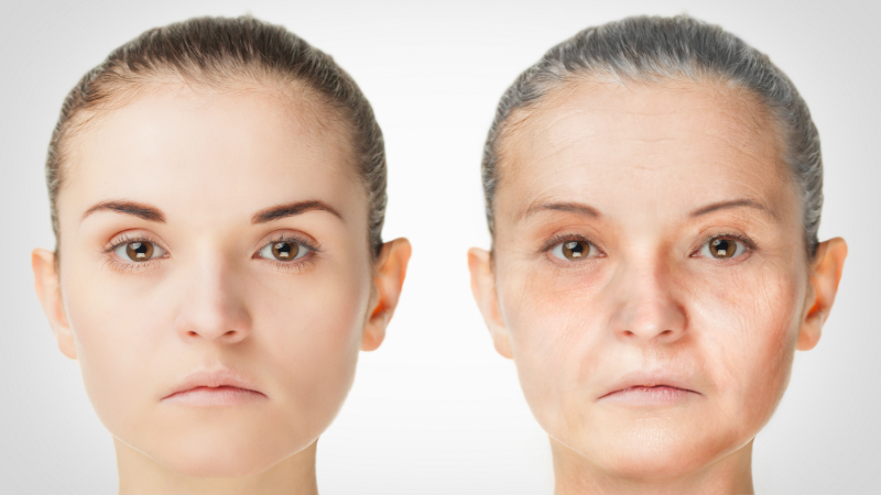 Droopy Eyelids Bothering You? Blepharoplasty Can Help